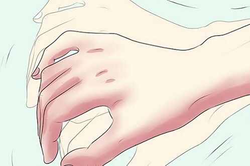 käte värisemine parasiitide esinemise sümptomina