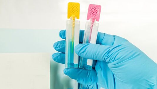 Parasiitide diagnostika meetodid